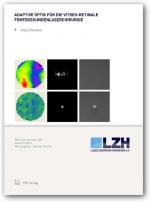 Cover-Bild Adaptive Optik für die vitreo-retinale Femtosekundenlaserchirurgie