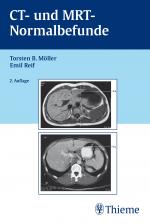 Cover-Bild CT und MRT Normalbefunde