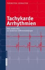 Cover-Bild Tachykarde Arrhythmien