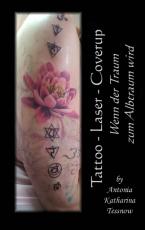 Cover-Bild Tattoo - Laser - Cover Up