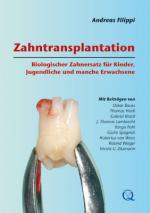 Cover-Bild Zahntransplantation