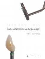 Cover-Bild Zero Bone Loss: Knochenerhaltende Behandlungskonzepte