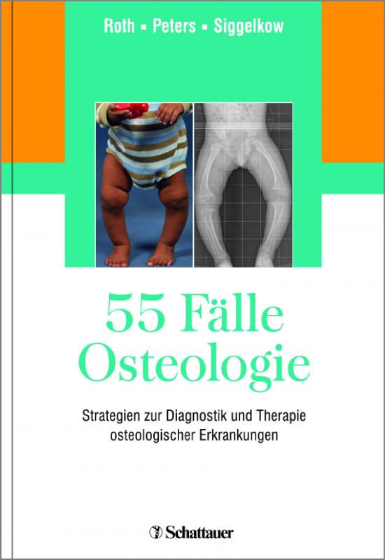 Cover-Bild 55 Fälle Osteologie
