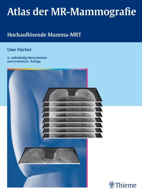 Cover-Bild Atlas der MR-Mammografie