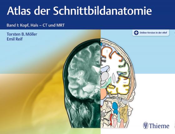 Cover-Bild Atlas der Schnittbildanatomie