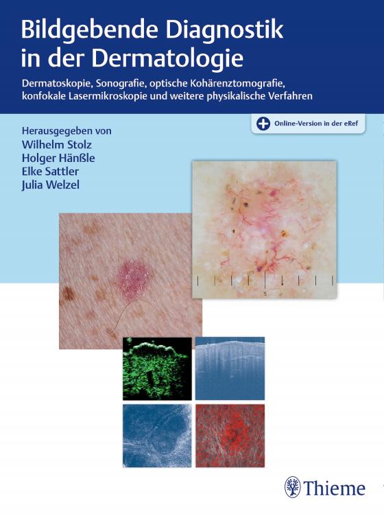 Cover-Bild Bildgebende Diagnostik in der Dermatologie