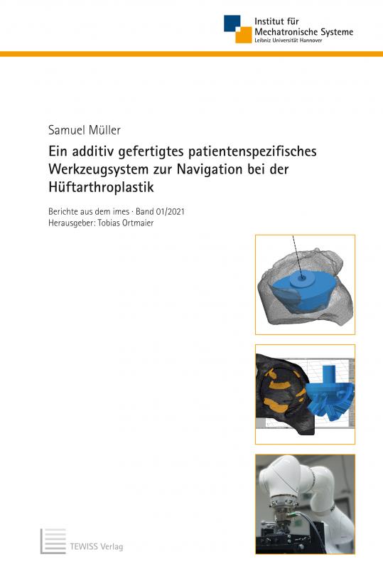 Cover-Bild Ein additiv gefertigtes patientenspezifisches Werkzeugsystem zur Navigation bei der Hüftarthroplastik