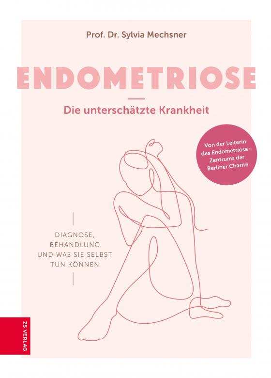 Cover-Bild Endometriose - Die unterschätzte Krankheit