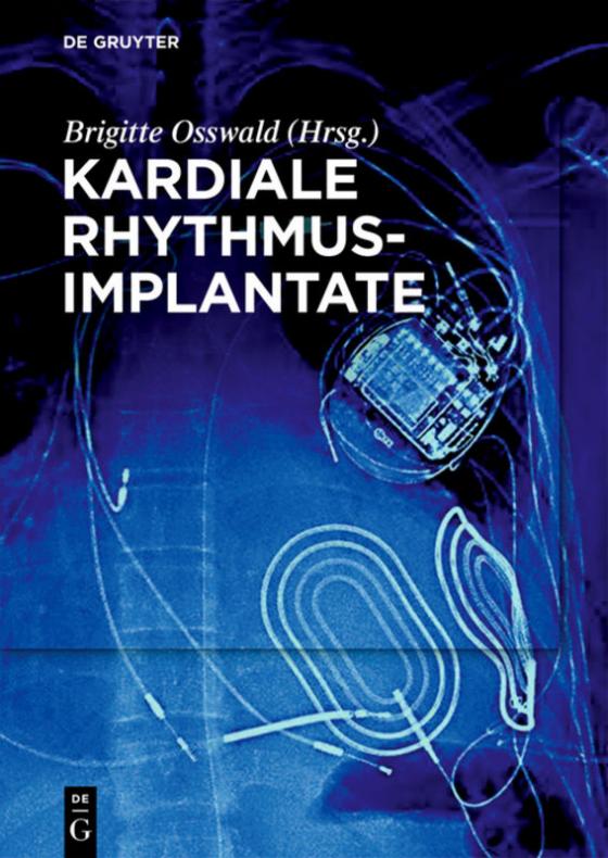 Cover-Bild Kardiale Rhythmusimplantate