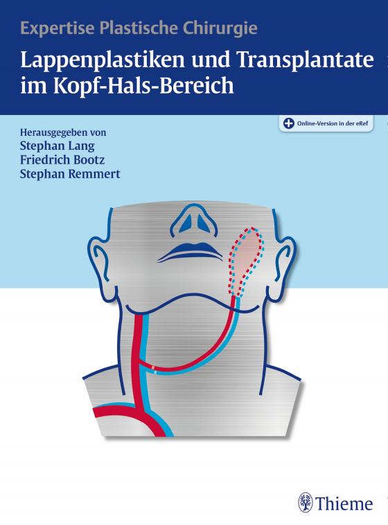 Cover-Bild Lappenplastiken und Transplantate im Kopf-Hals-Bereich