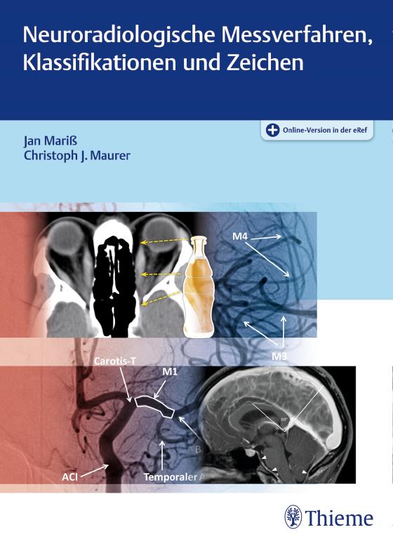 Cover-Bild Neuroradiologische Messverfahren, Klassifikationen und Zeichen