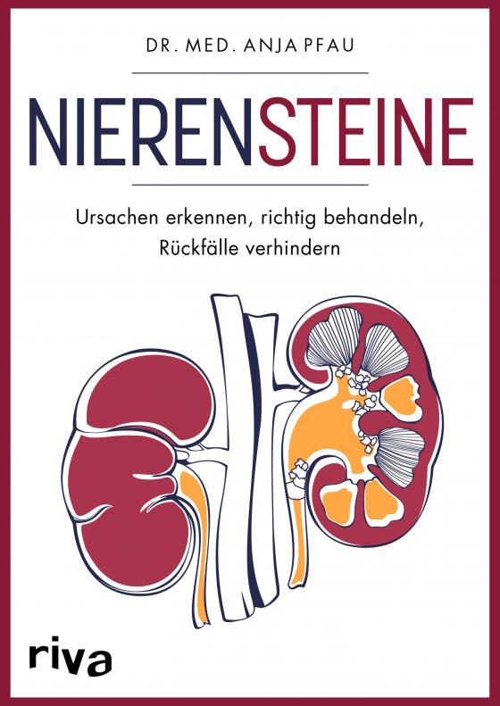Cover-Bild Nierensteine – Ursachen erkennen, richtig behandeln, Rückfälle verhindern