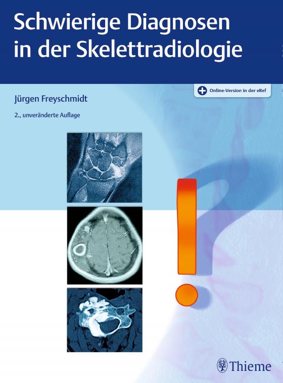 Cover-Bild Schwierige Diagnosen in der Skelettradiologie