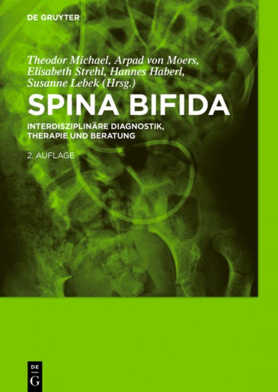Cover-Bild Spina bifida