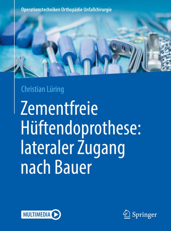 Cover-Bild Zementfreie Hüftendoprothese: lateraler Zugang nach Bauer
