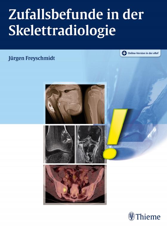 Cover-Bild Zufallsbefunde in der Skelettradiologie